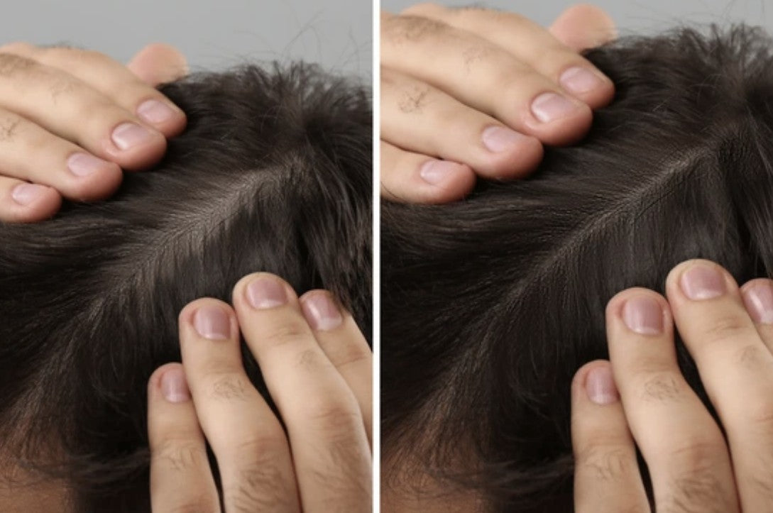 Pack Shampoo + Serum Anticaída Disaar